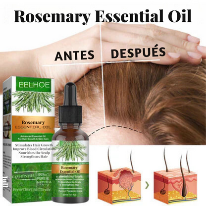 Rosemary Oil Blend | Hair Growth™